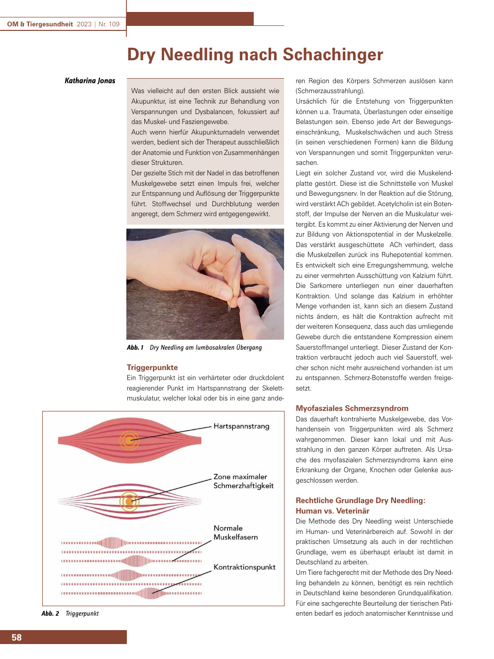 Dry Needling nach Schachinger